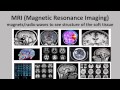 Brain Scans and Their Functions