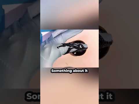 Why You Never Suck Out Snake Poison 😰