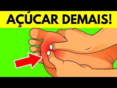 8 Sinais de que Você Está Consumindo Açúcar Demais