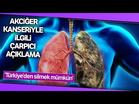 Akciğer Kanseri | Prof. Dr. Kutluk:  Akciğer Kanserini Türkiye’den Silmek Mümkün