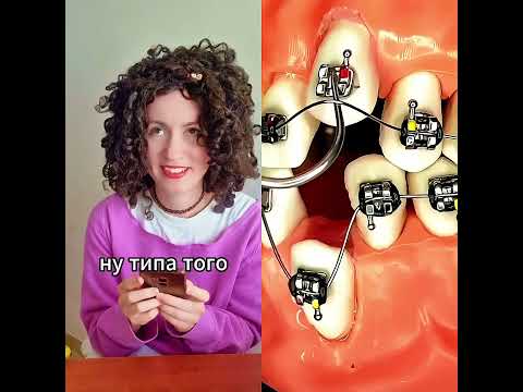 #braces #funny #foryou #braceslife #pov