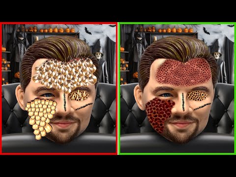 Scary ASMR Remove Maggots & Ticks From Leonardo Dicaprio | Severely Injured Treatment Animation