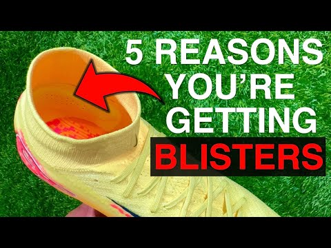 5 Reasons why your football boots GIVE YOU BLISTERS