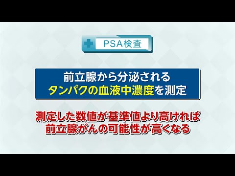 【知りたい！がん検診】Vol.725回「前立腺がんの検診方法」