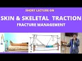 Traction Methods in Fracture Management