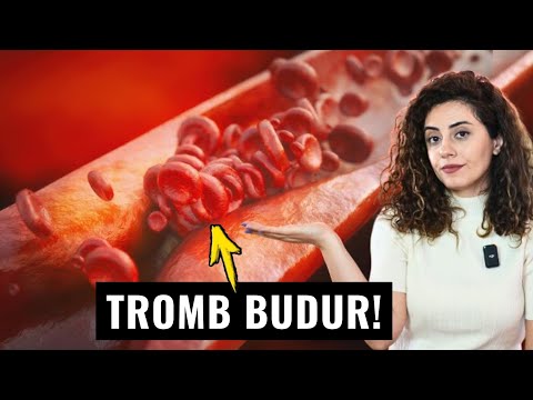 Damarlarda TROMBU Əridən Qidalar Bunlardır - Qanı Laxtalanmağa Qoymur!