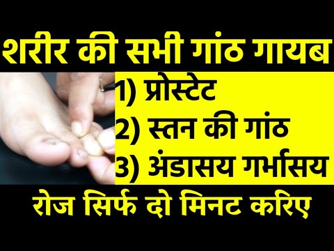 Amazing FINGER MASSAGE for any tumor cyst fibrosis ovary cyst uterus fibroid prostate enlargement