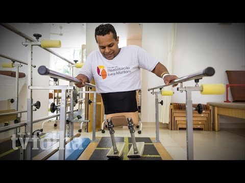 Meio-homem, meio prótese: DJ passa por cirurgia rara, retira 40% do corpo