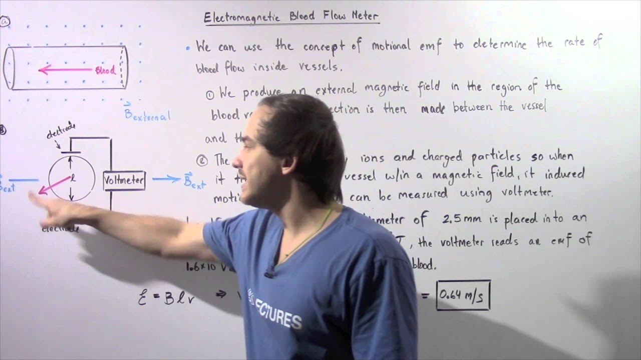 Electromagentic Blood Flow Meter and Motional emf