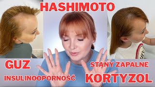 Co z tym moim zdrowiem? 🚑 Aktualizacja. Film do posłuchania.
