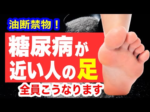 糖尿病が近い人だけに起こる「足の異変」見逃すと足を失います！