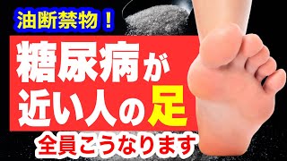 糖尿病が近い人だけに起こる「足の異変」見逃すと足を失います！