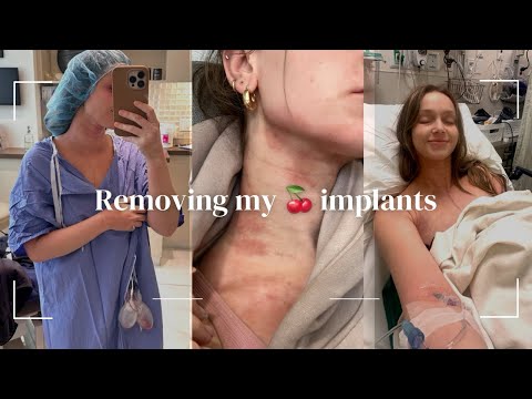 Taking out my breast implants that were making me sick *DO I REGRET MY DECISION!?*