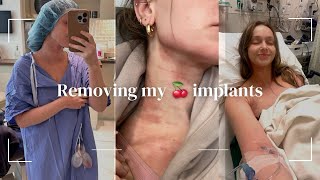 Taking out my breast implants that were making me sick *DO I REGRET MY DECISION!?*