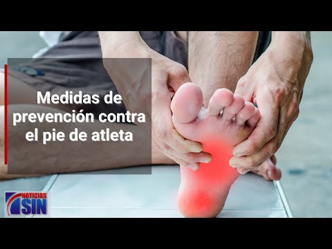 ¿Qué es el pie de atleta y cómo prevenirlo?