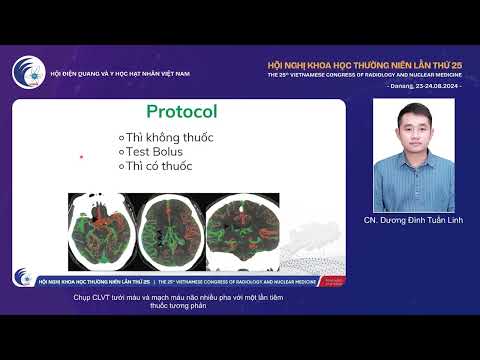 6. Chụp CLVT tưới máu và mạch máu não nhiều pha với một lần tiêm thuốc (CN. Dương Đình Tuấn Linh)