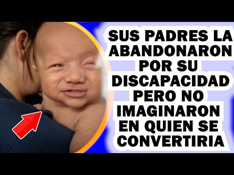 Sus Padres La Abandonaron al Nacer Por su Discapacidad, Nunca imaginaron en Quién Se Convertiría.