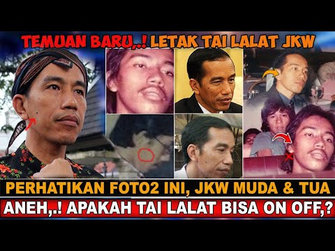 🔴MATA ELANG NETIZEN BIKIN MELOTOT,.! PERHATIKAN LETAK TAI LALAT PAK JOKOWI,.!