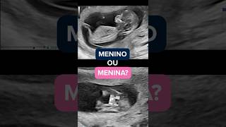 MENINO OU MENINA?