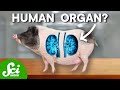 Organ Transplantation and Xenotransplantation
