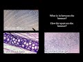 Types and Features of Cartilage