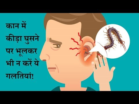 कान में कीड़ा घुस जाने पर अपनाएं यह घरेलू उपाय, कीड़ा तुरंत बाहर निकल जाएगा