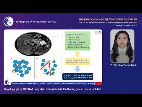4. Ứng dụng giá trị ADC/DWI trong chẩn đoán phân biệt tổn thương gan (BS. Trần Hồng Phương Dung)