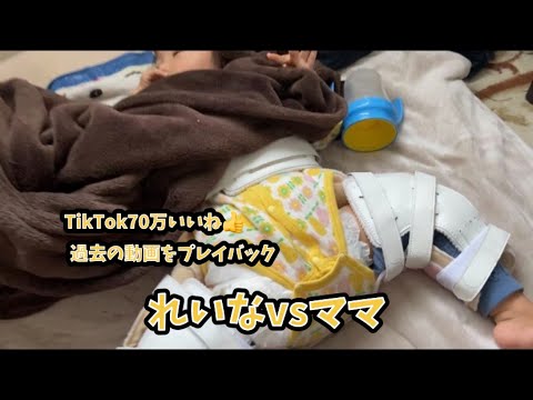 【股關節脱臼】れいなvsママ 裝具をつけるかつけないか!TikTok70萬いいね👍過去の動畫をプレイバック