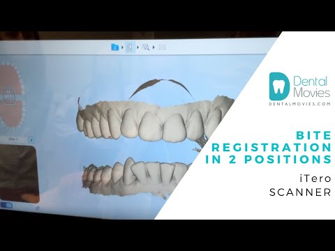 Bite registration 🔎🦷  in 2 POSITIONS -  iTero scanner