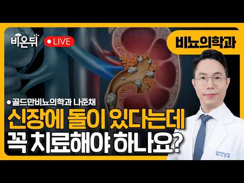 #39.신장에 돌이 있다는데, 꼭 치료해야 하나요?/ 골드만비뇨의학과 나준채 [닥터우동]