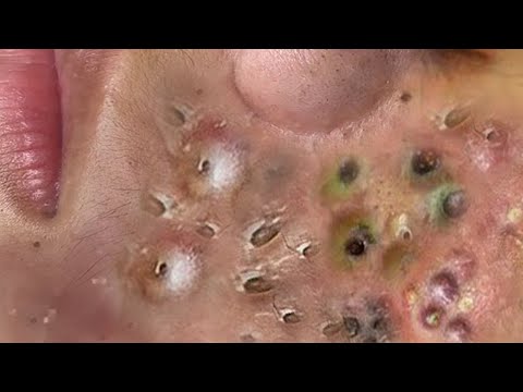 طرق حماية بشرة الوجهCC6700