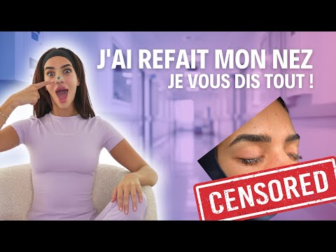 J'AI REFAIT MON NEZ, JE VOUS DIS TOUT !! 😱