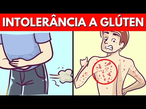 14 sinais surpreendentes de que você é intolerante ao glúten