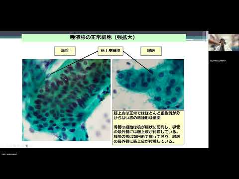 「がんと正常を細胞診で見抜く」 検査技術科学専攻 教授 齊尾征直