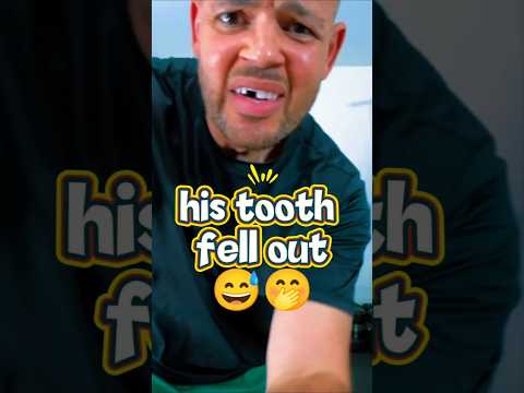 Amazing!! his tooth fell out❗😅🤭#shorts #shortvideo
