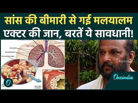 Malayalam Actor Meghnathan का 60 साल की उम्र में निधन, सांस की दिक्कत से गवानी पड़ी जान | Asthma