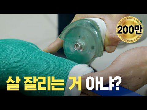 [ENG] 왜 깁스는 위험하게 전기톱으로 자를까?