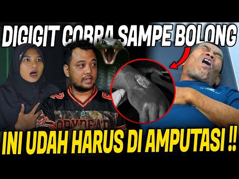 NOLONG KORBAN GIGITAN ULAR COBRA PENYEMBUR !! TANGANNYA UDAH BOLONG DAN BERN4N4H !!