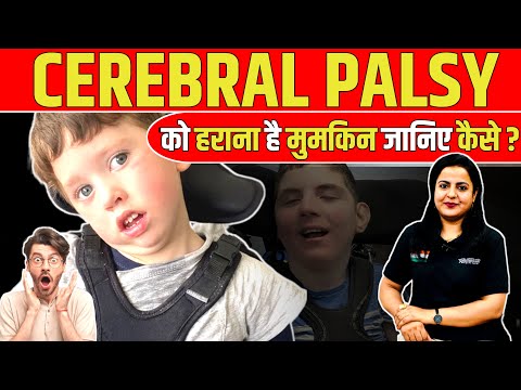 CEREBRAL PALSY को हराना हुआ आसान | जानिए इसके इलाज और Therapy हिंदी में | Dr Arvind Jaga
