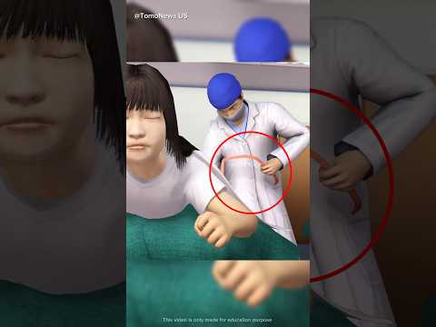 Strangest Things Found Inside Human Bodies 😨