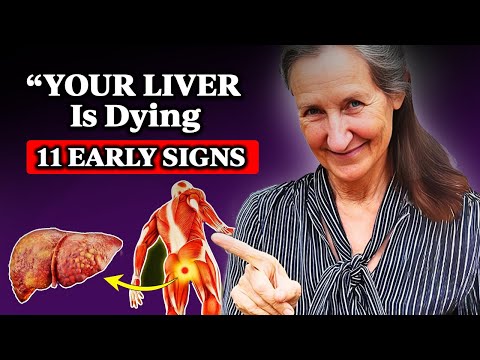 12 Weird Signs of Liver Damage | Barbara O'Neill