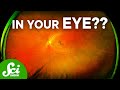 Retinal Imaging and Health