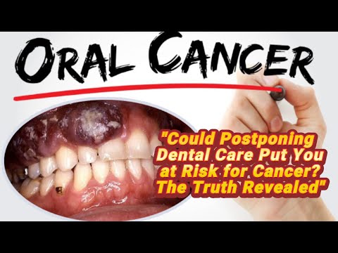 "Could Postponing Dental Care Put You at Risk for Cancer? The Truth Revealed"