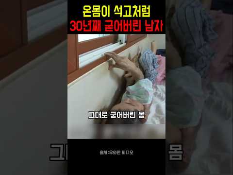 온몸이 석고처럼 30년째 굳어버린 남자