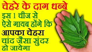 चेहरे से दाग धब्बे कैसे मिटाए - Chehre Ke Daag Dhabbe Kaise Dur Karen - How To Remove Pigmentation