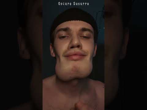 Top 5 Mewing