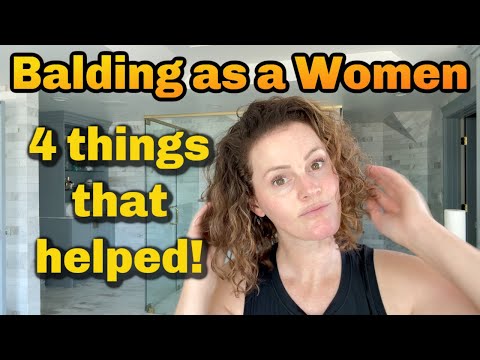 4 Things That Helped My THINNING HAIR!