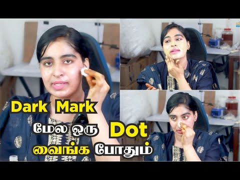 எனக்கும் Acne mark dark spot , pigmentation நிறைய இருந்துச்சு | Dark Mark மேல ஒரு Dot வைங்க போதும்.