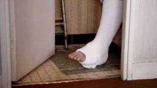 Moving toes on a plaster wamlking cast
