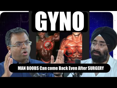 Gyno firse aa sakta hai even after surgery| #gynacomastia reoccurrence